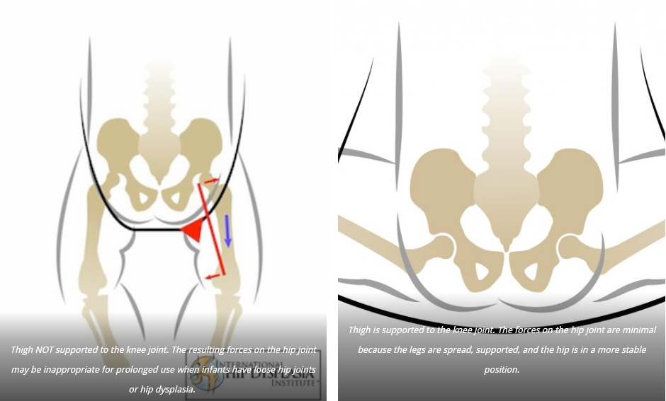 Image showing optimum position for babies hips to prevent hip dysplastia